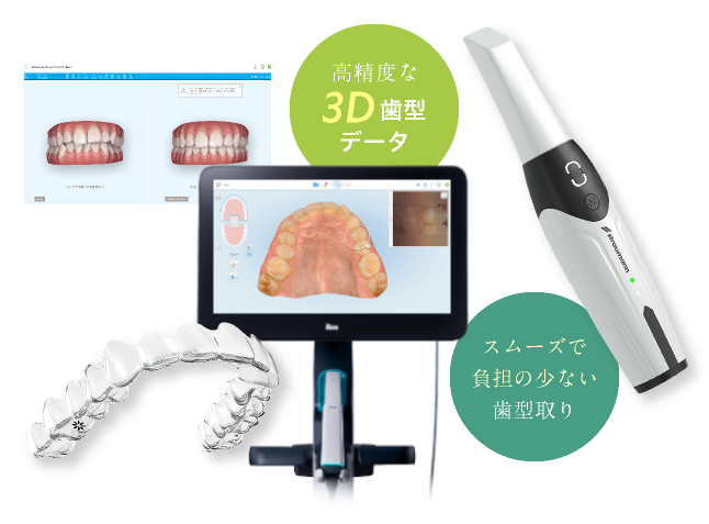 高精度な3D歯型データ スムーズで負担の少ない歯型取り