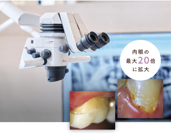 肉眼の最大20倍に拡大/予測CTによる高精細・立体撮影