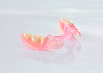 ノンクラスプデンチャー