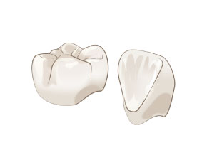 ジルコニア クラウン(前歯/臼歯)