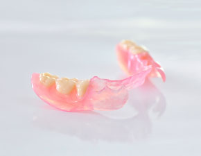 ノンクラスプデンチャー