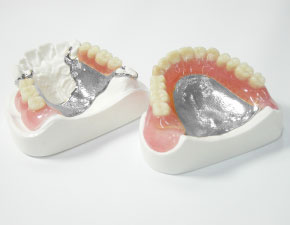 金属床とのコンビネーション設計代